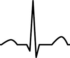 What is a Cardiac Event Monitoring study